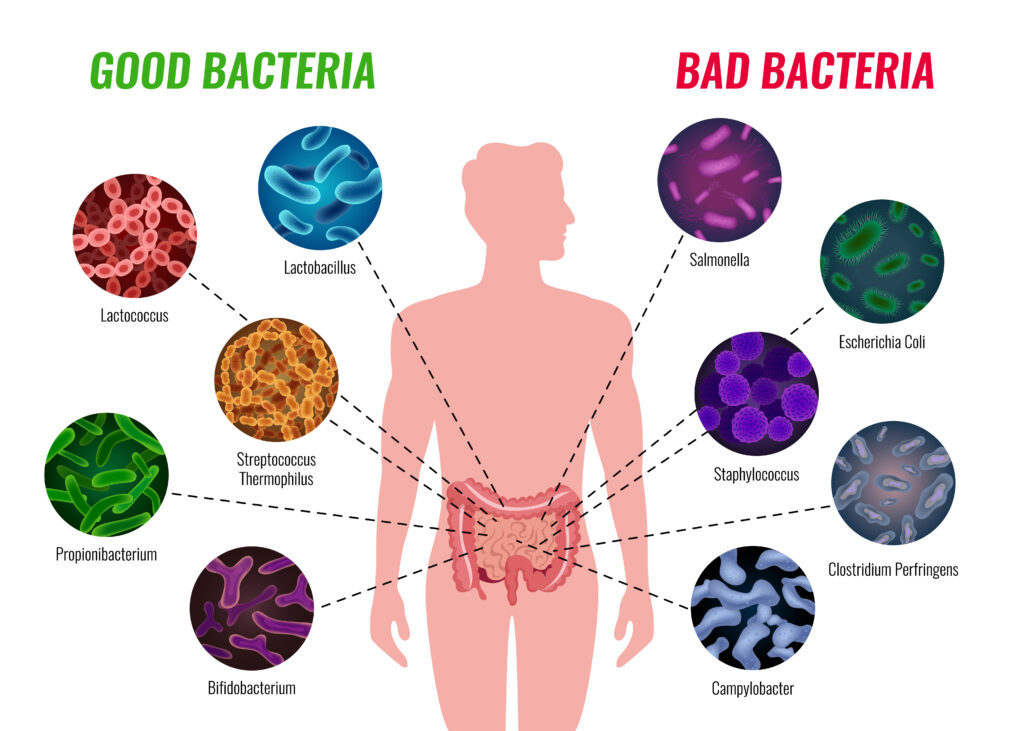 Probiotics, good bacteria, bad bacteria, dysbiosis, prebiotics